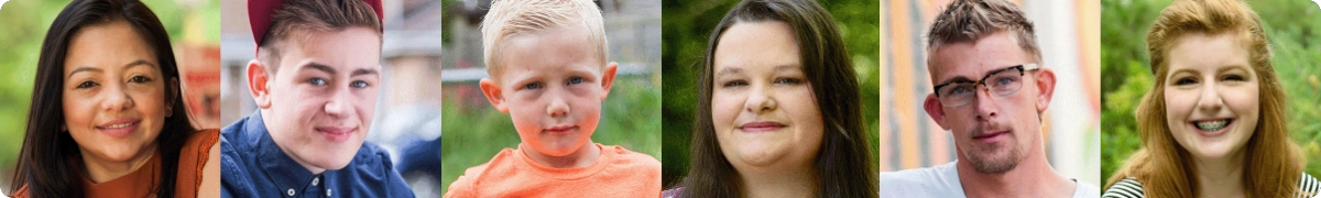 Gezichten van patiënten met ASMD.