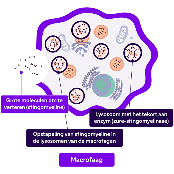 Zieke cel die volraakt met sfingomyeline stapeling.