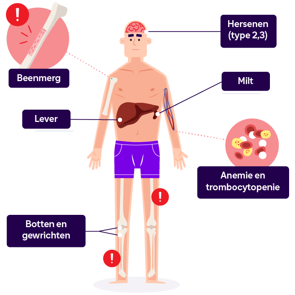 Symptoompop met weergave van lever en milt