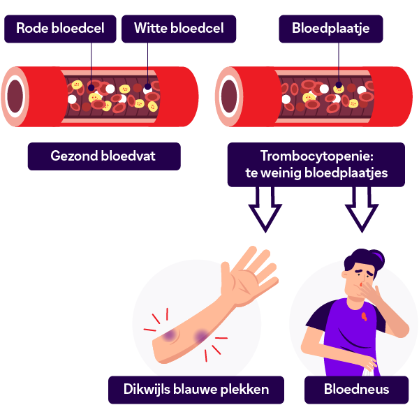 Weergave van bloedarmoede