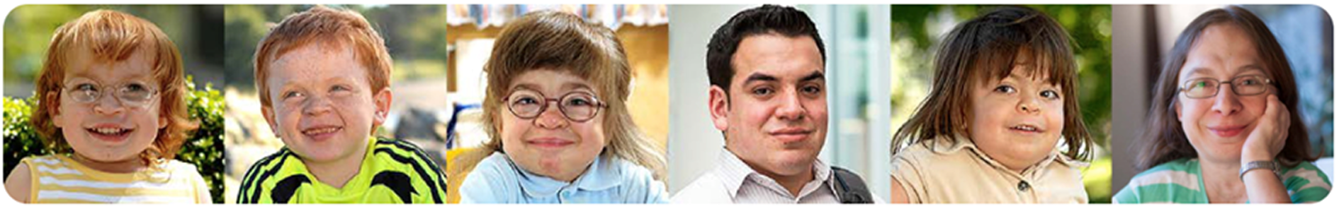 Gezichten van patiënten met MPS1.