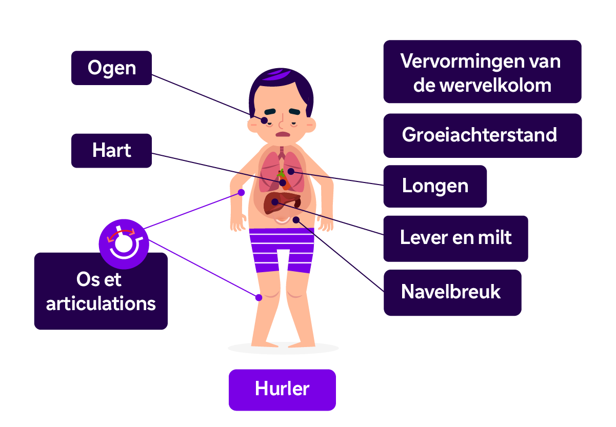Een zieke man met typische symptomen van MPSI