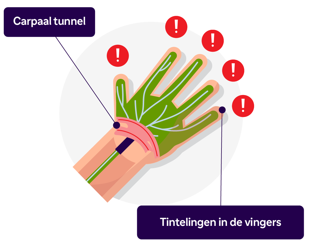 Een hand met tintelingen in de vingers.